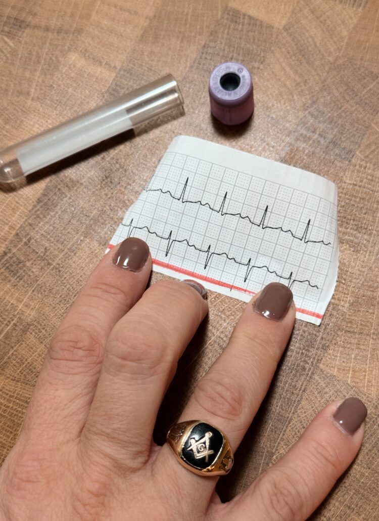 a woman's hand with fingernail polish wearing a man's Masonic ring. Holding a printout of a heartbeat.