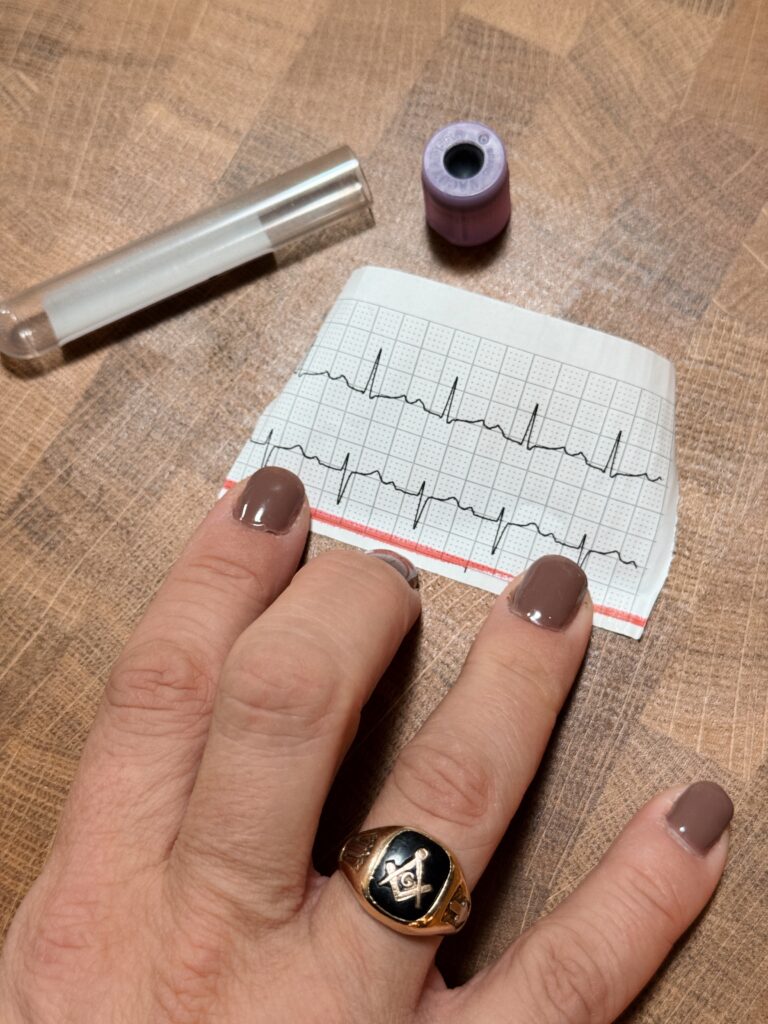 a woman's hand with fingernail polish wearing a man's Masonic ring. Holding a printout of a heartbeat.