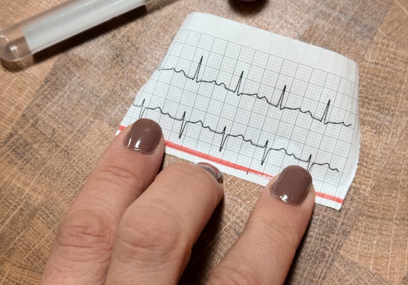 a woman's hand with fingernail polish wearing a man's Masonic ring. Holding a printout of a heartbeat.